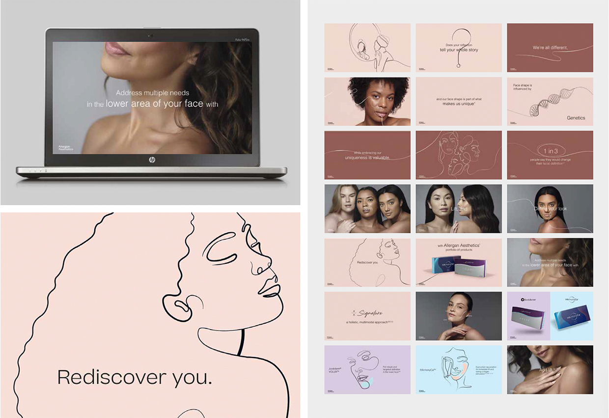 Allergan Aesthetics Storyboard Concept